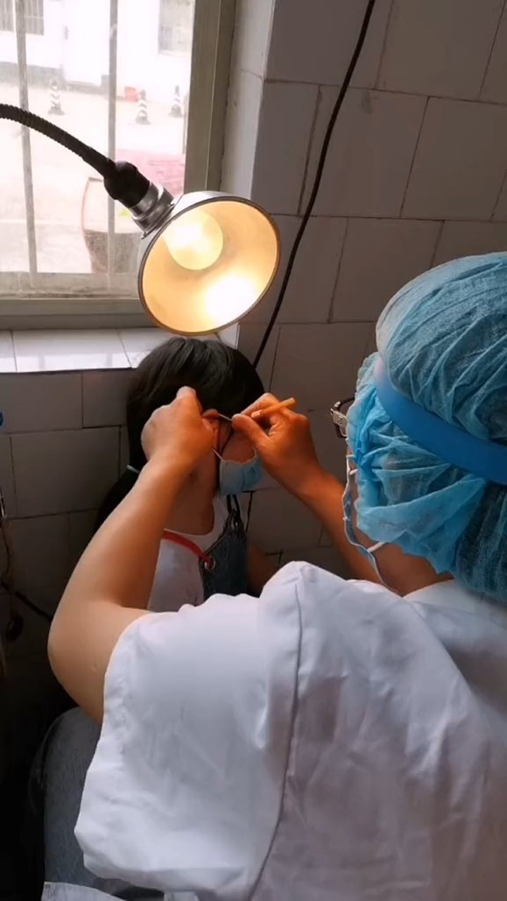 最近女儿耳朵发痒听力不好去医院掏耳屎医生居然说是耳朵有点聋了我
