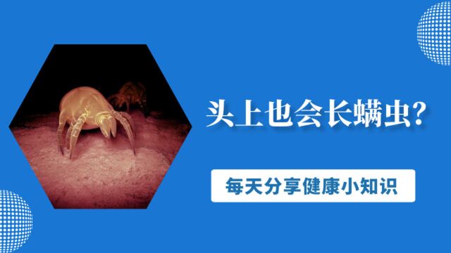 头上也会长螨虫?提醒:若出现这4种迹象,八成是螨虫堆积成山了