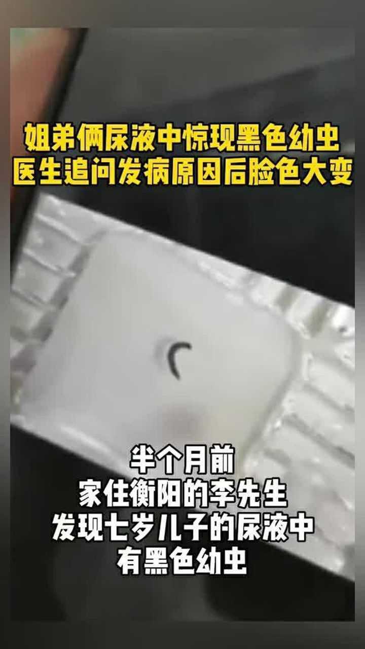 "虫子直接尿出来"!姐弟俩尿液中惊现黑色幼虫