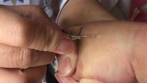 儿护护士必备的技能,就是能够单手推针,扎针技术必须比外科还专业!