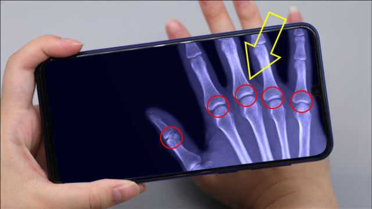 教你设置手机x光扫描仪连手掌的骨头都能透视像拍ct一样清晰