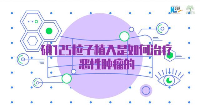 【健康解码ⷥ䧥Œ𛨮𚩁“】李闻:碘125粒子植入是如何治疗恶性肿瘤的?