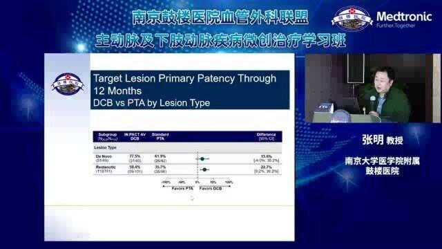 张明教授《DCB在血管通路狭窄性病变中的应用》