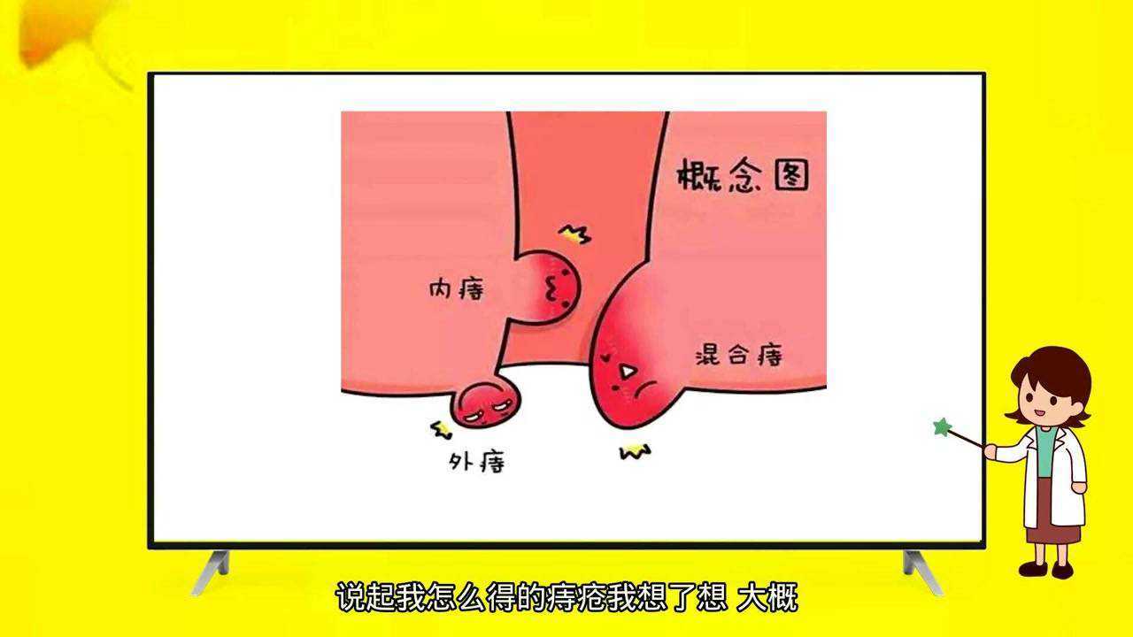 肛門疼有個肉疙瘩怎麼回事竟是痔瘡惹得禍