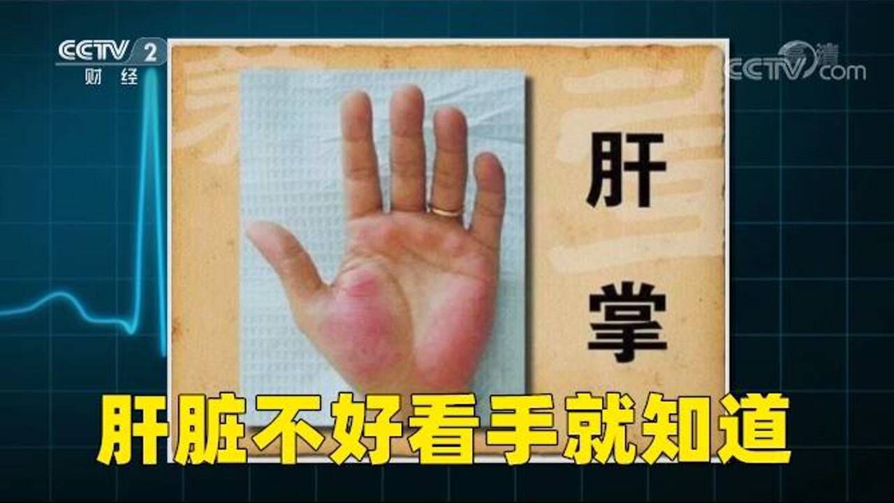 肝脏不好看手就知道手掌长期发红可能是“肝掌”_高清1080P在线观看平台_腾讯视频