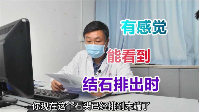 男子复查结石是否下去?医生发现已到末端,排出时能感觉出来!