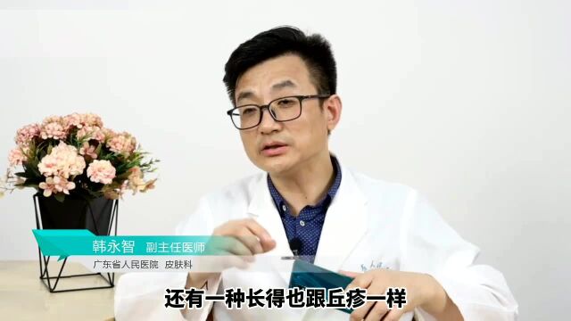 丘疹样的痘痘应该怎么去除?来听听皮肤科专家怎么说