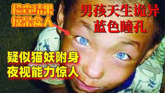 男孩天生诡异蓝色瞳孔,疑猫妖附身夜视能力惊人,检查结果惊众人