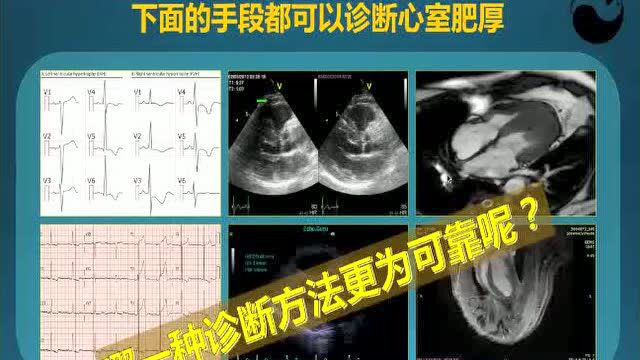 【才俊讲堂】孔令秋:左心室肥厚的基本概念