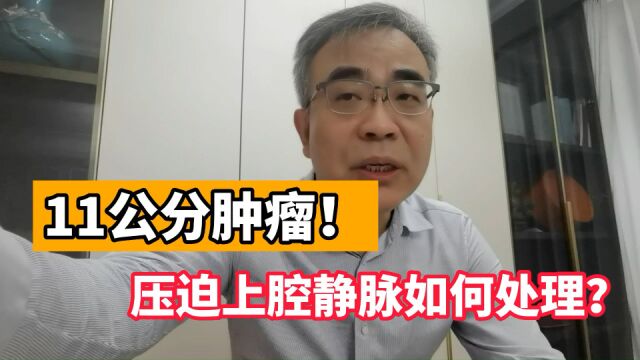 肿瘤11公分压迫上腔静脉,可以直接手术吗?医生:我建议您先药物治疗