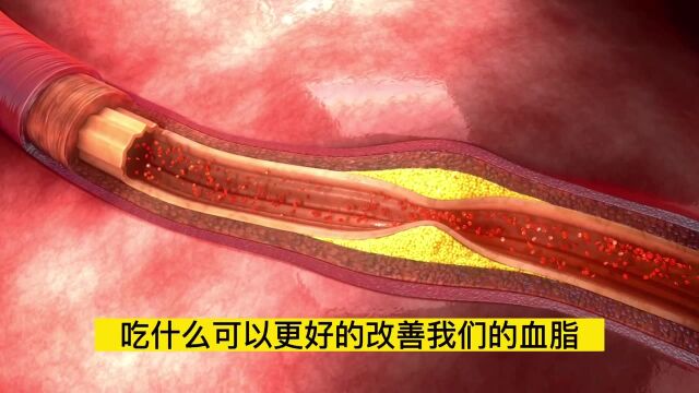 血脂高的人吃什么?医生科普:这7种食物换着吃,利于血管健康