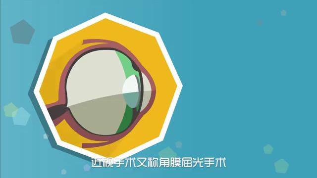 阿玛仕Smart全激光简介