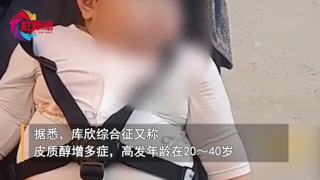 1岁多娃体重61斤?