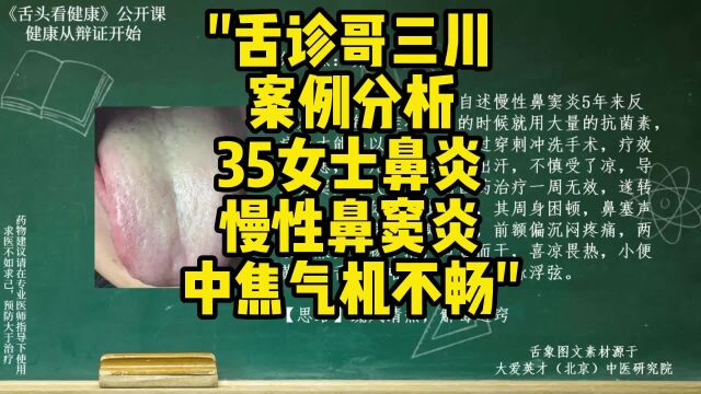 舌诊哥分析:36女士,鼻炎慢性,鼻窦炎,中焦气机不畅