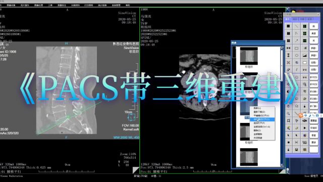 VC++6.0开发的PACS医学影像工作站 DICOM标准化开发