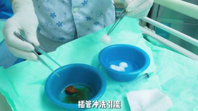 【视频】医路探诊ⷮŠ护理门诊 | 第3集 伤口与造口