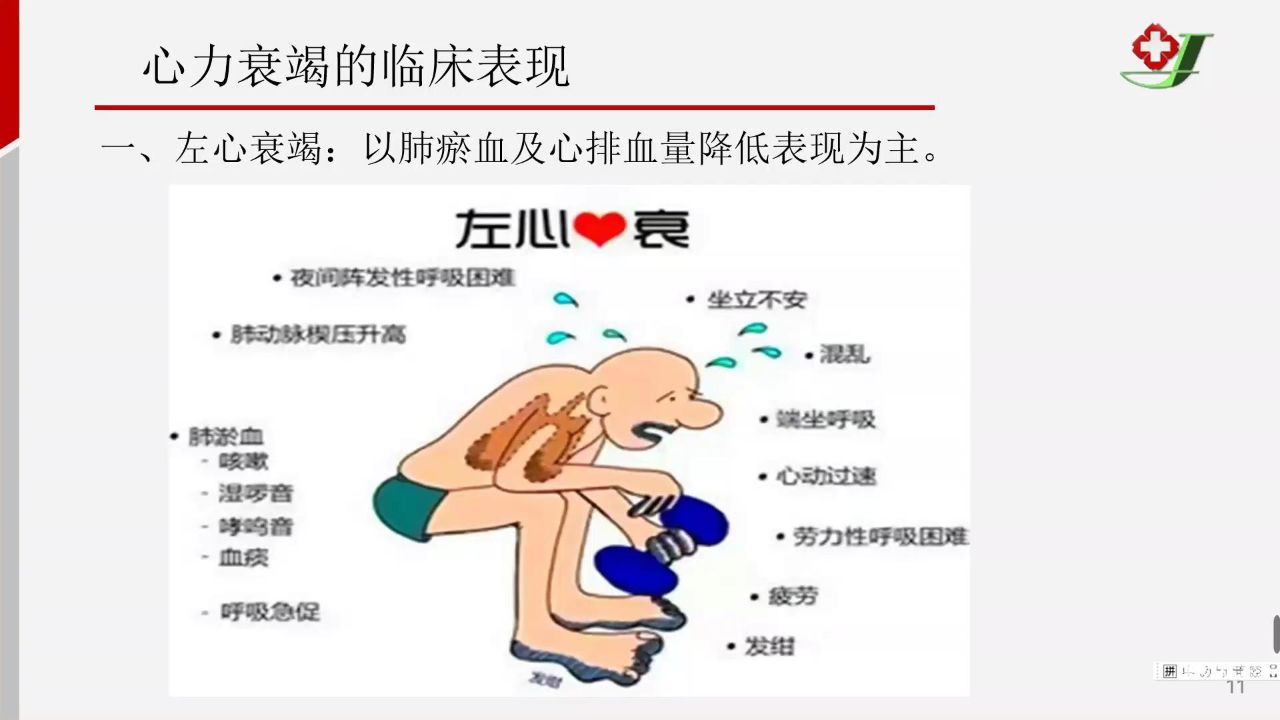 3.急性左心衰的抢救护理 - trim