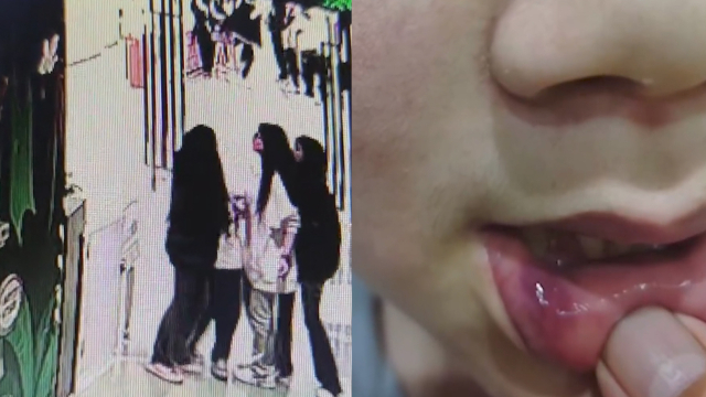 14岁女儿被3陌生女孩殴打20多分钟,父亲悬赏1万找打人者:希望她们道歉