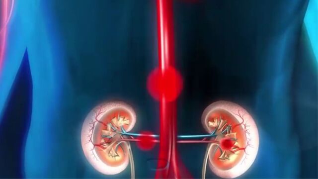 在人体中心脏和肾脏,就像一对难兄难弟,它们相互依存相互影响