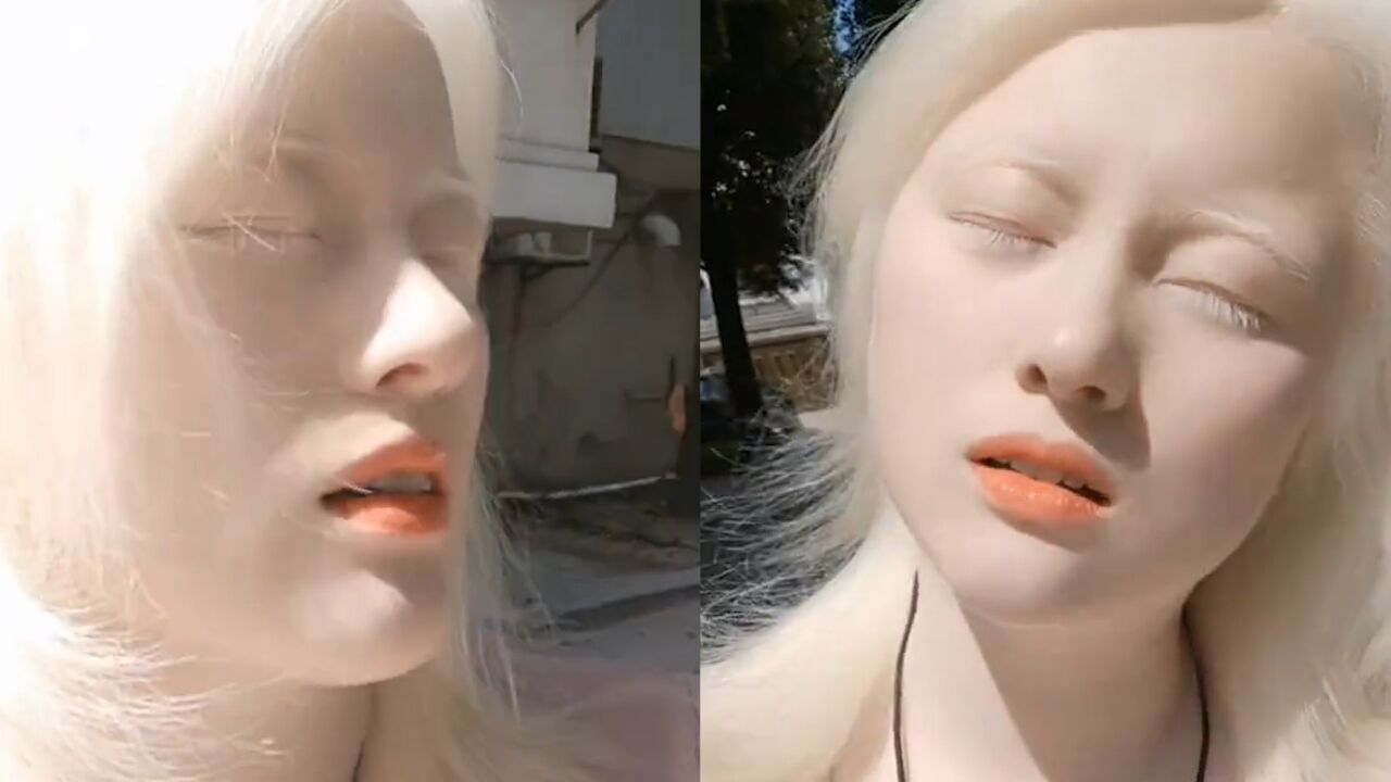 白化病女生在阳光下晒自拍,五官精致微微一笑惊艳,宛如天使下凡