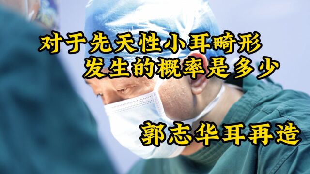 郭志华对于先天性小耳畸形发生的概率是多少