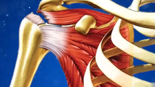 最常出现肩袖撕裂的部位冈上肌肌腱