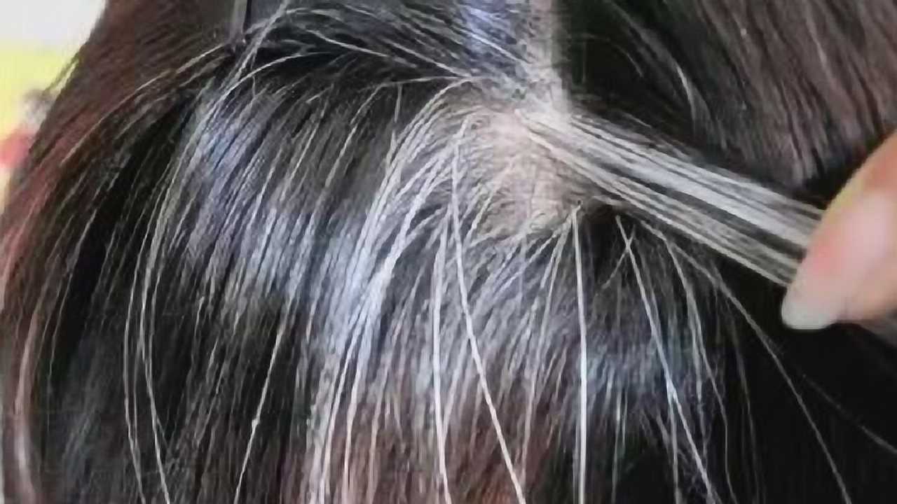 美国研究发现:这种东西,多吃会催生白发!难怪你白发越来越多