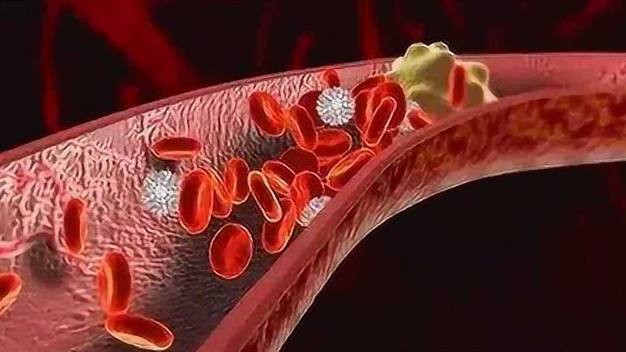 这些食物是血管清道夫,净化血液,清除血管垃圾,一辈子血管不堵