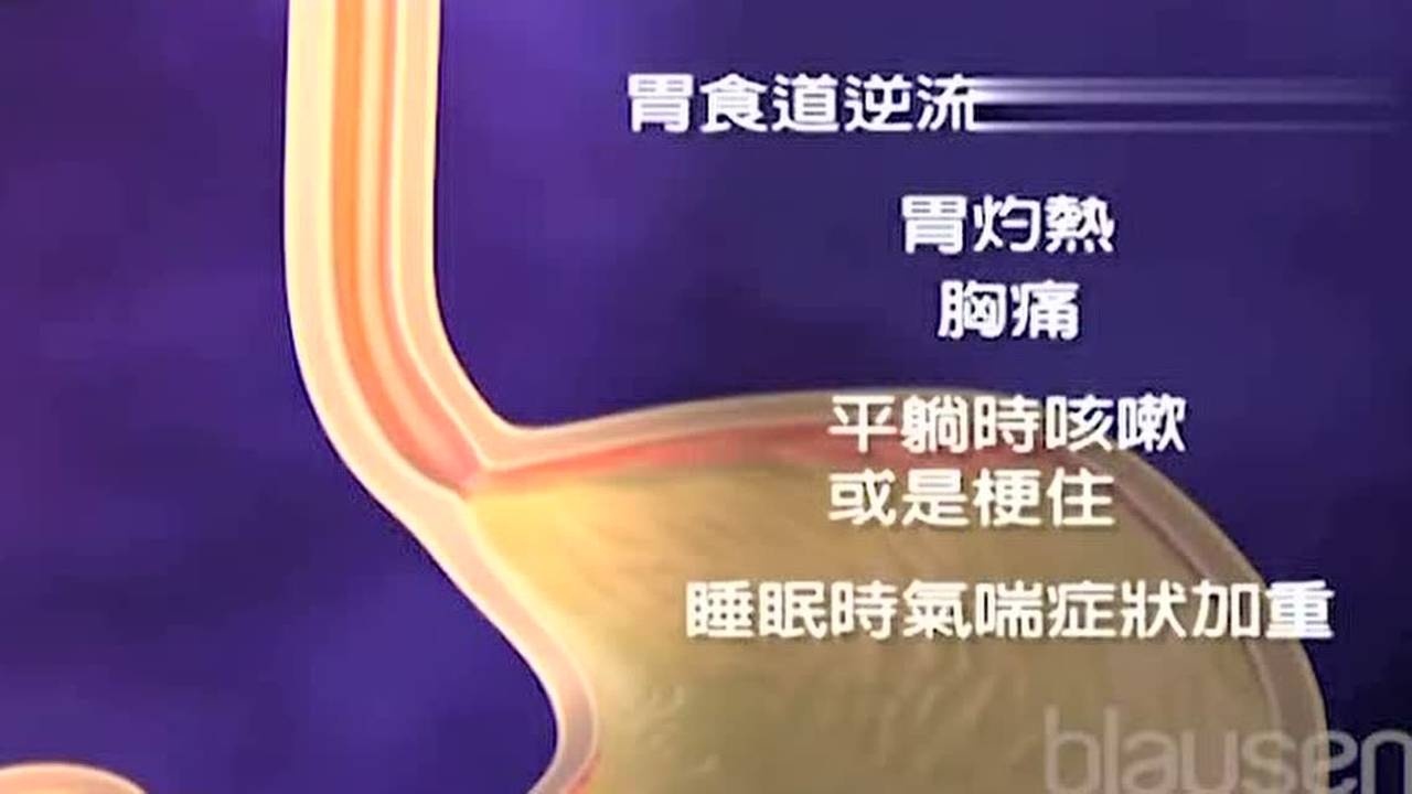 医学3D动画演示胃食管反流病及其常见症状_腾讯视频