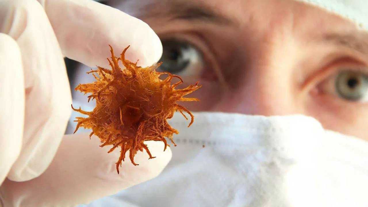 鼻咽癌早期的4种信号,是"我"的忽视才把它当做鼻炎治.