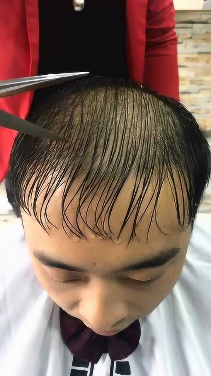 秃顶换个发型变帅哥