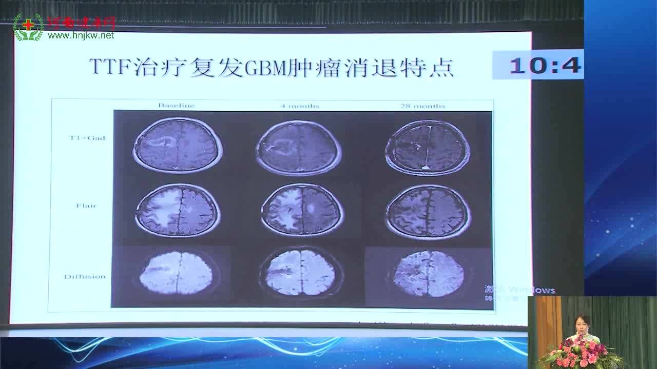 陈媛媛-肿瘤治疗电场新纪元