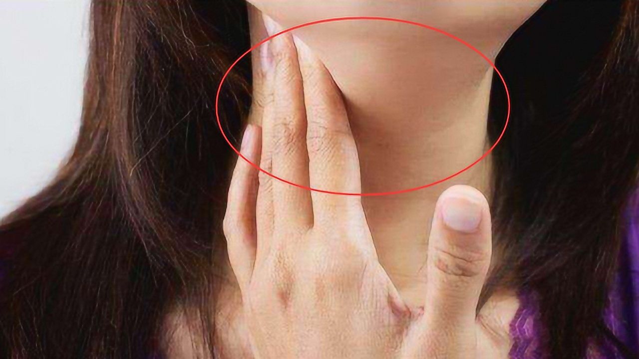 淋巴癌早期不疼不痒一旦脖子上出现这东西说明癌细胞被激活了