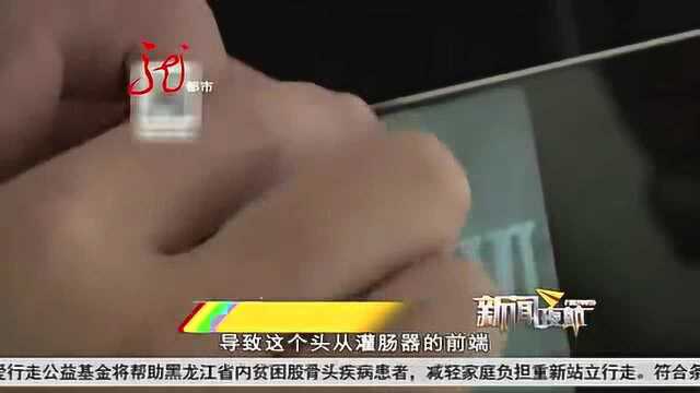 灌肠器“蹿”进直肠 太不小心了