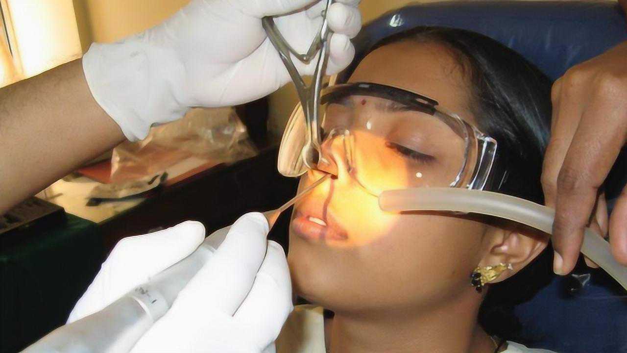 为什么很多鼻炎患者在手术后都自杀了医生简直生不如死