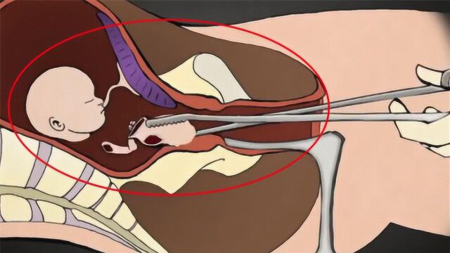 3D还原女性“打胎”全过程:场面极其残忍,男人们都看哭了!