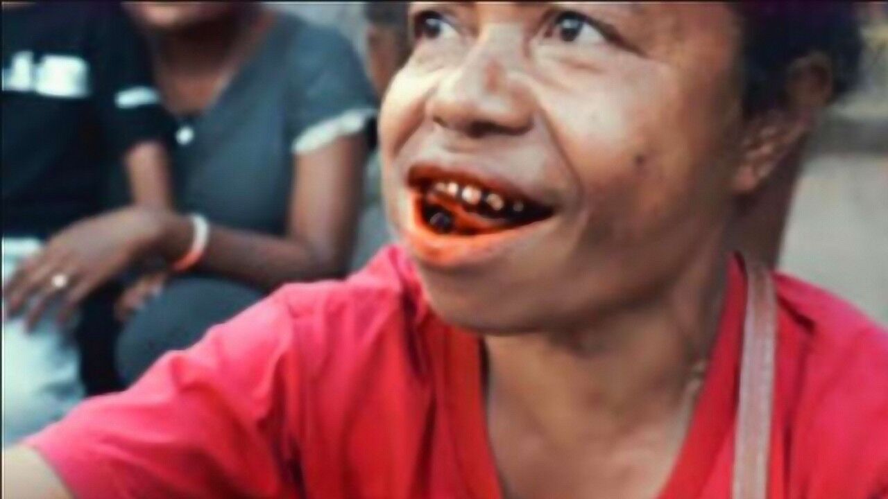 吃槟榔危害有多大农村大叔嚼槟榔12年如今连水都喝不下了