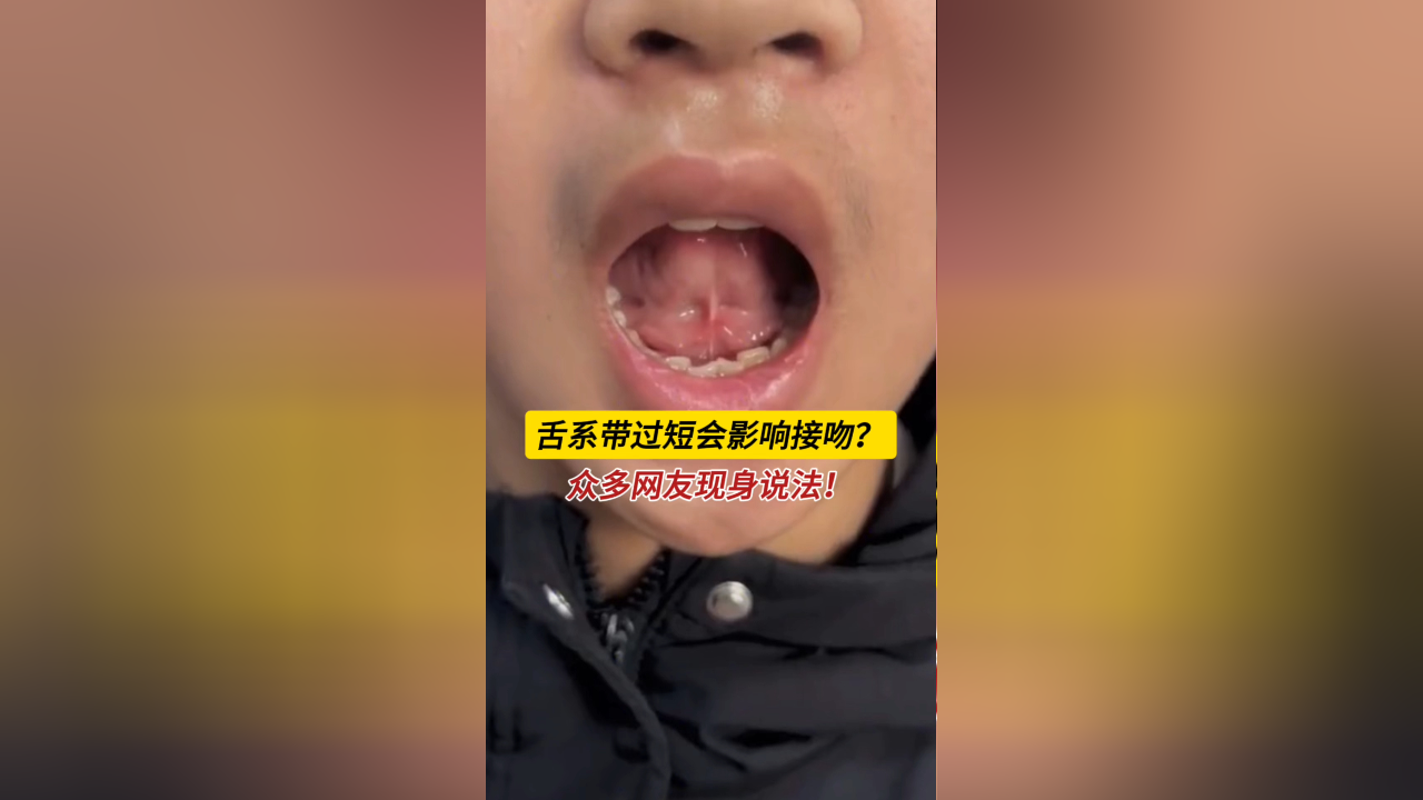 系带水肿是什么样子的图片