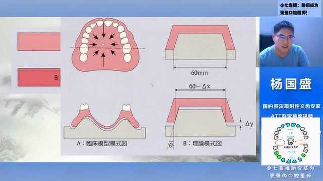 义齿暂基托的制作