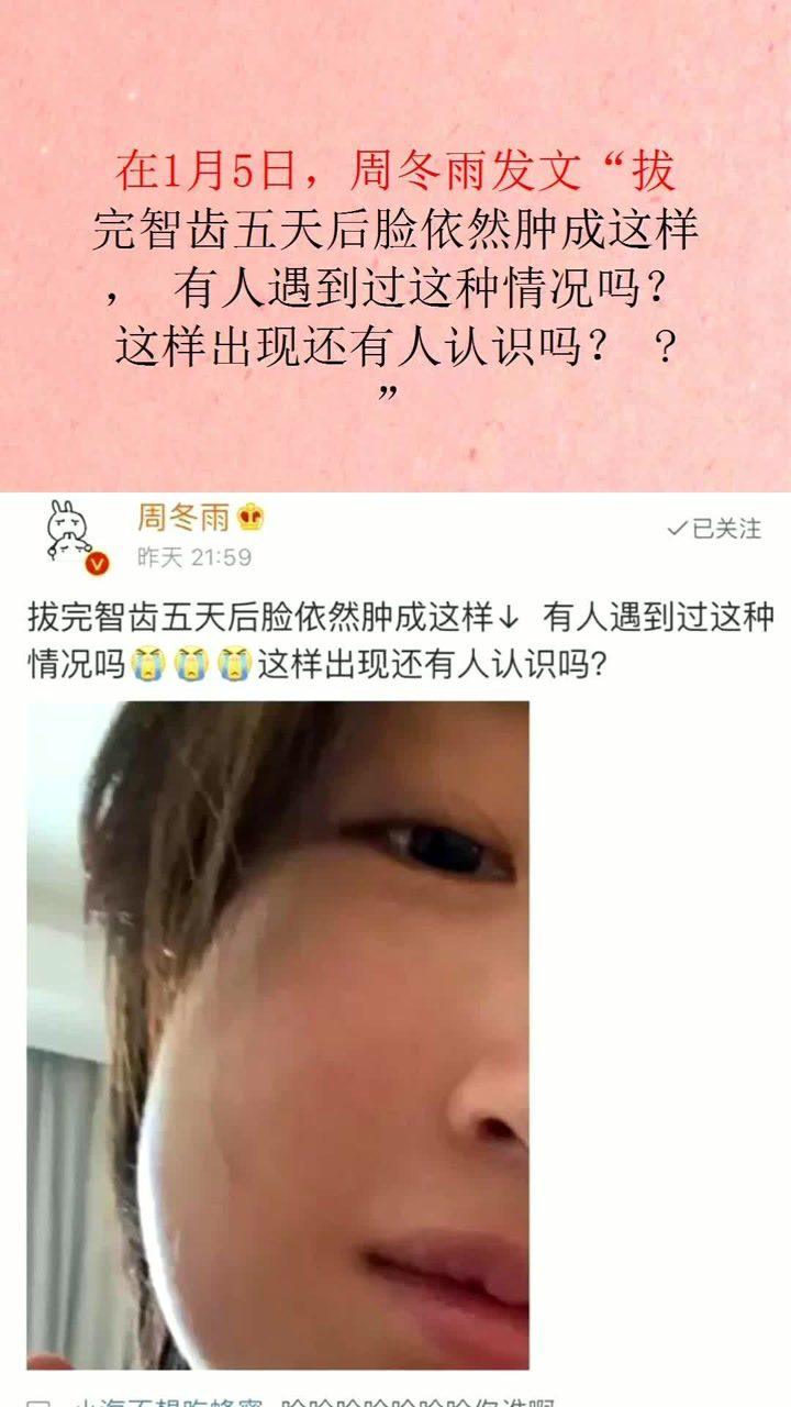 周冬雨拔牙智齿脸肿网友太坏了各种恶搞p图