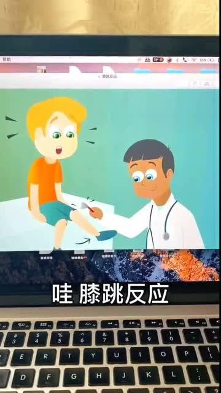 我去!你这膝跳反射,让我防不胜防啊.