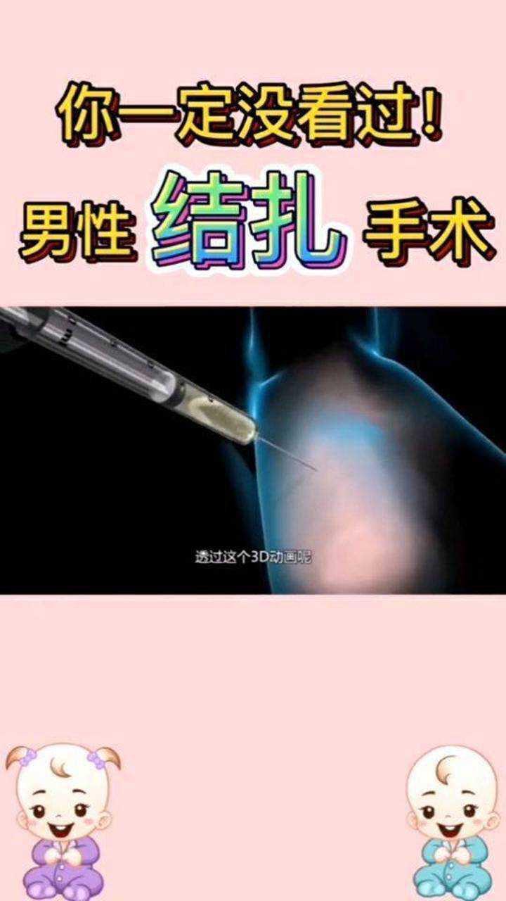 你一定没看过男性的结扎手术吧