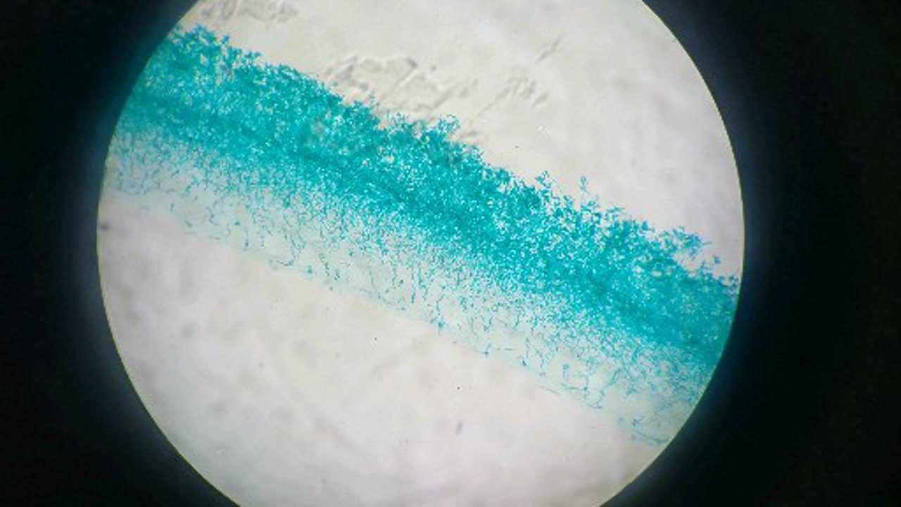 显微镜观察青霉菌