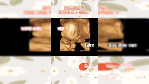 杭州玛莉亚妇产医院四维检查时新生儿都在干嘛呢