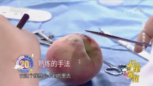 给水果做双眼皮手术？整形医生现场展示双眼皮手术过程