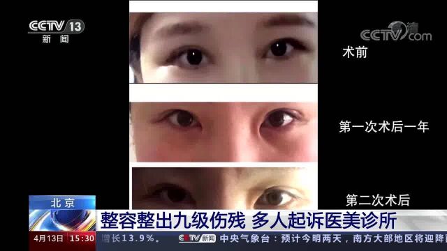 北京 整容整出九级伤残 多人起诉医美诊所