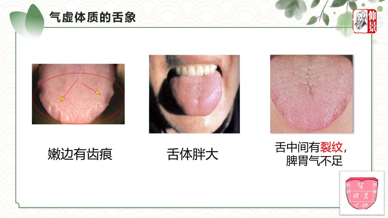 中医谈九种体质-气虚体质_高清1080P在线观看平台_腾讯视频