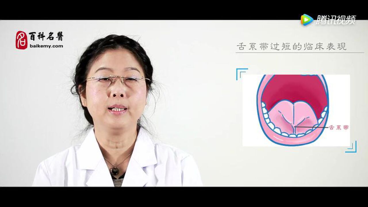 舌系带过短健康宣教_腾讯视频
