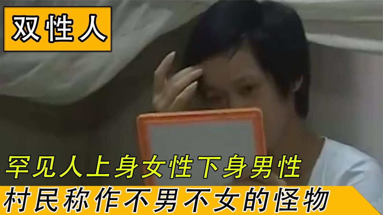 罕见"双性人"上半身女性,下半身男性,医生也难以分辨雌雄.