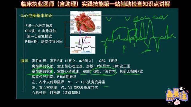 临床执业医师(含助理)实践技能第一站心电图知识点讲解